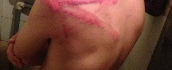 beatings