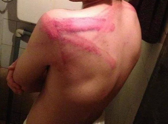 beatings